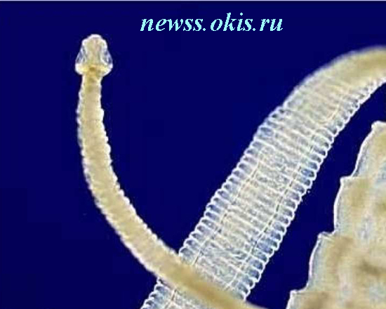 фото червь паразит